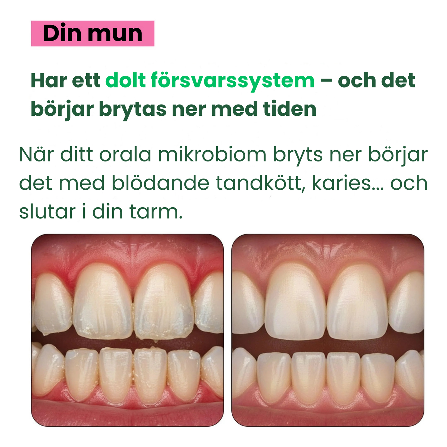 Oral Defence – Maximal styrka för återställning av munnens mikrobiom